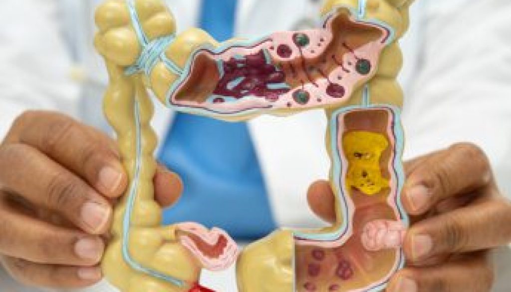 Intestine, appendix and digestive system, doctor holding anatomy