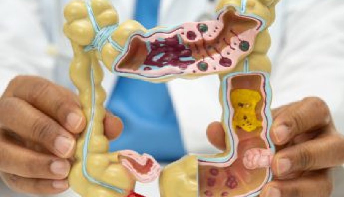 Intestine, appendix and digestive system, doctor holding anatomy