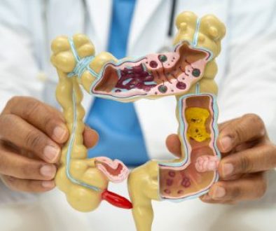 Intestine, appendix and digestive system, doctor holding anatomy