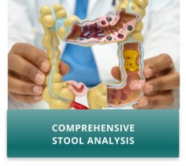 Intestine, appendix and digestive system, doctor holding anatomy